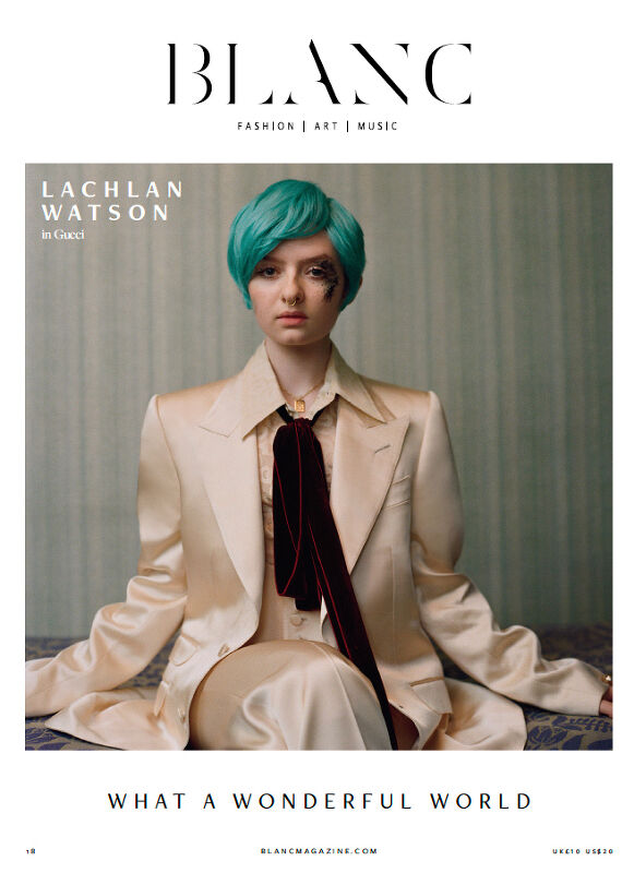 Lachlan Watson, Blanc