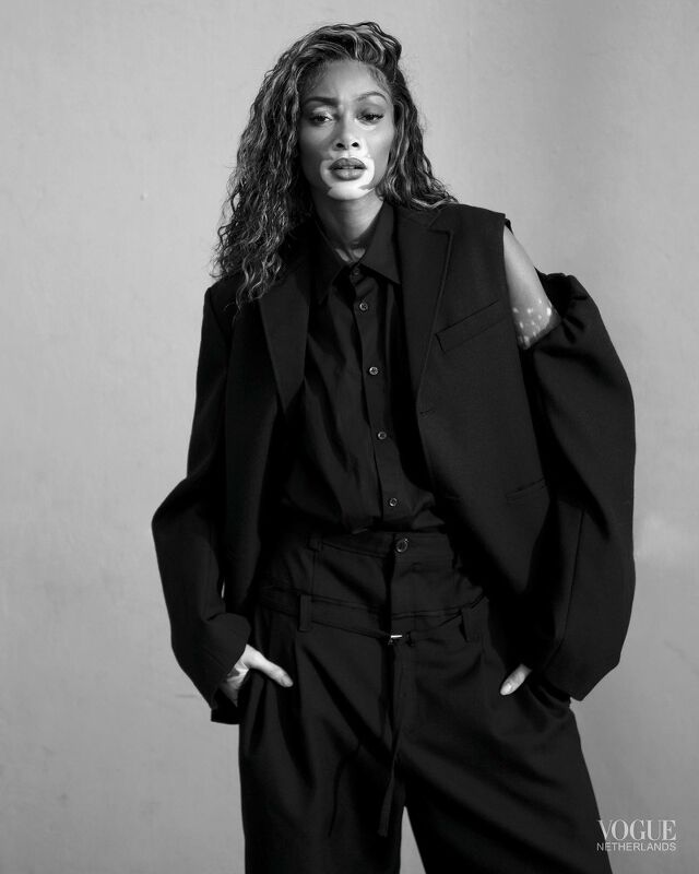 Winnie Harlow, Vogue Netherlands