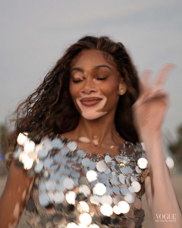 Winnie Harlow, Vogue Netherlands