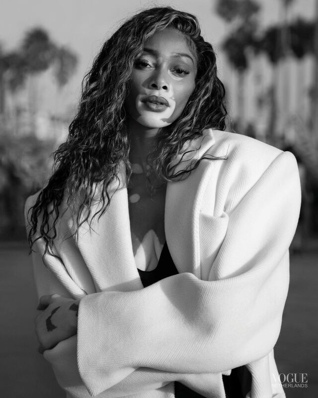 Winnie Harlow, Vogue Netherlands